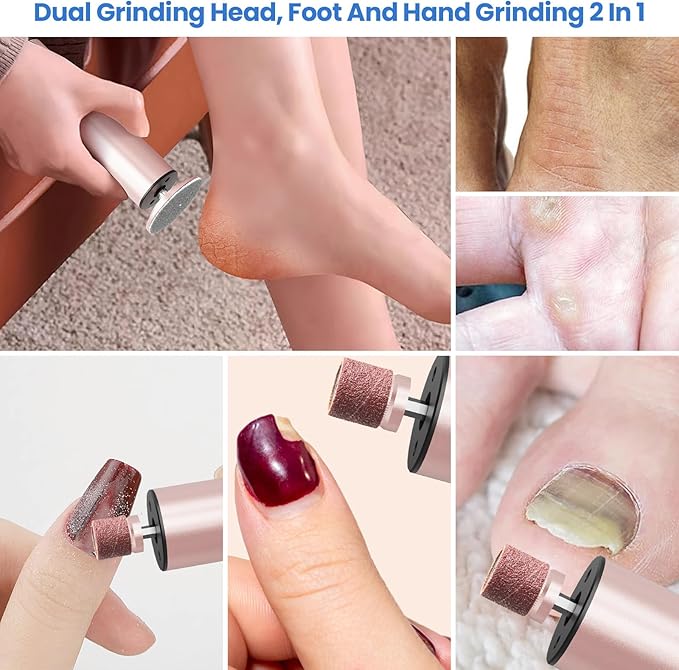 Electric callus remover for feet,