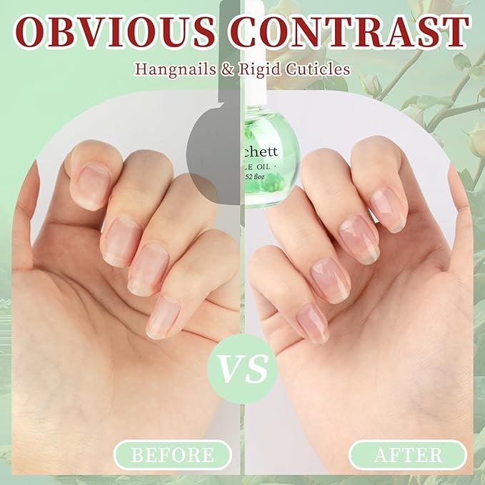 Meschett Cuticle Oil for Nails,Cuticle