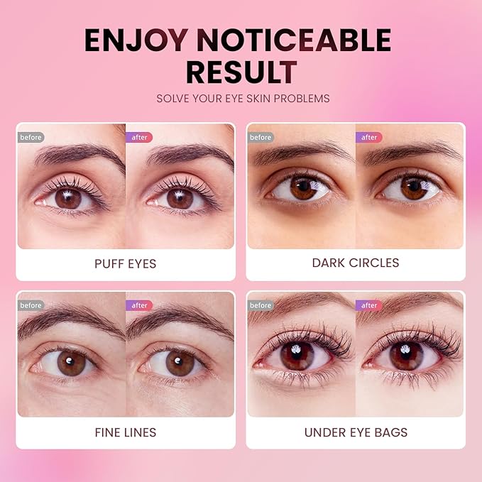 Under eye patches (20 pairs)-new