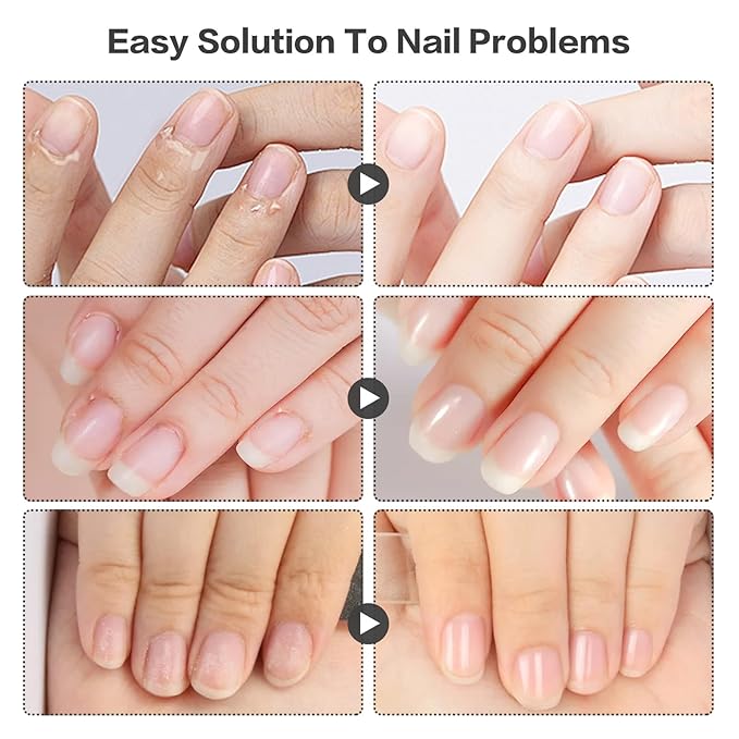 Radiant Nail Growth Oil, Nail