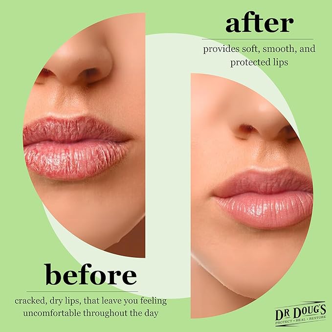 Dr. Doug's Lip Logic (2 pack)