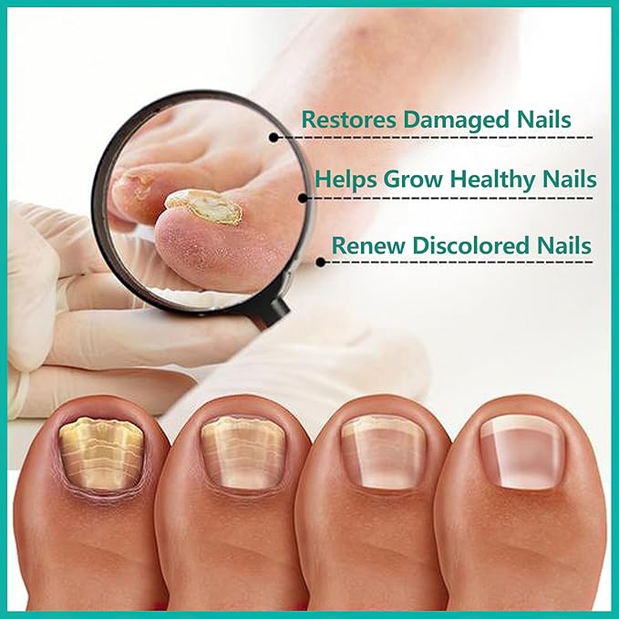 MIELIKKI Nail Repair Cream, Nail