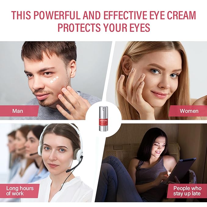 Retinol eye cream for dark