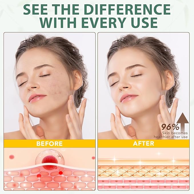 4.2oz Grass Fed Beef Tallow for Women and Girls, Organic Grass Fed and Finished Tallow For Skin - Face & Body(Unscented)