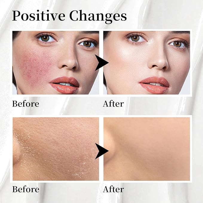 Grass-Fed Beef Tallow for Skin Made in USA, Absorbent, Soothing Tallow and Honey Balm, Smoother Beef Tallow for Face, Whipped Beef Tallow Moisturizer, Tallow Cream (2oz. Vanilla Scented)