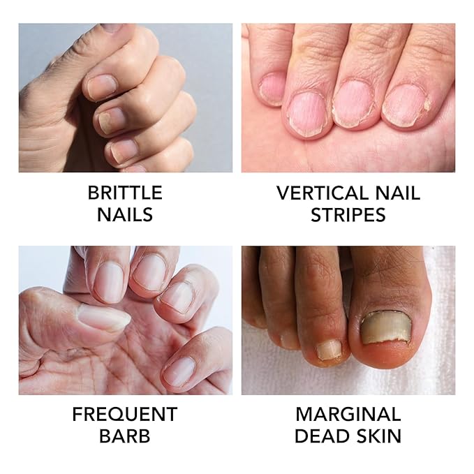 Moisturizing Cuticle Oil for Nails,