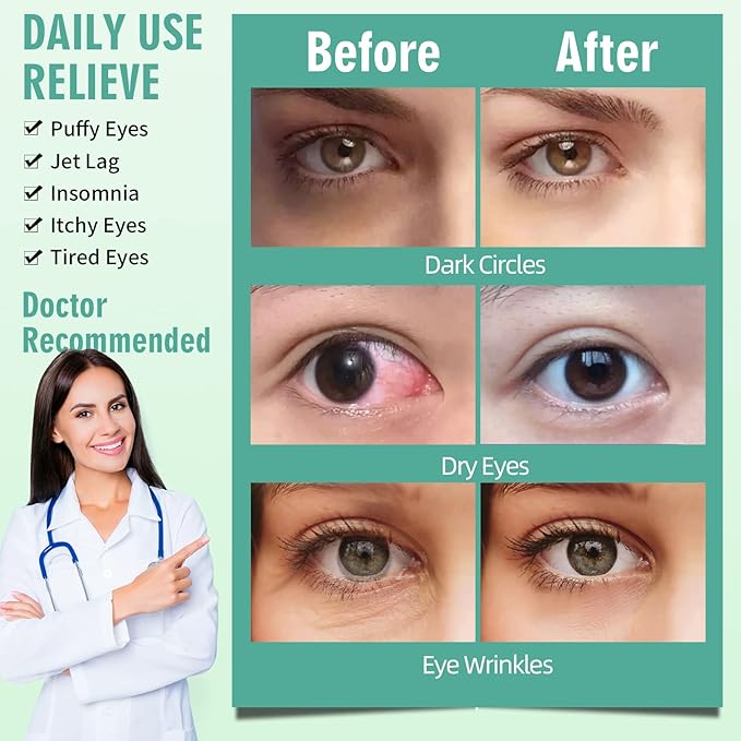 Serfeymi 22 packs steam eye