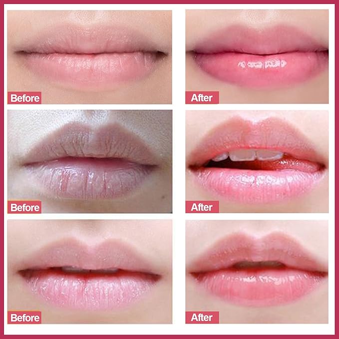 Lip Scrub, Lip Scrubs Exfoliator, Sugar