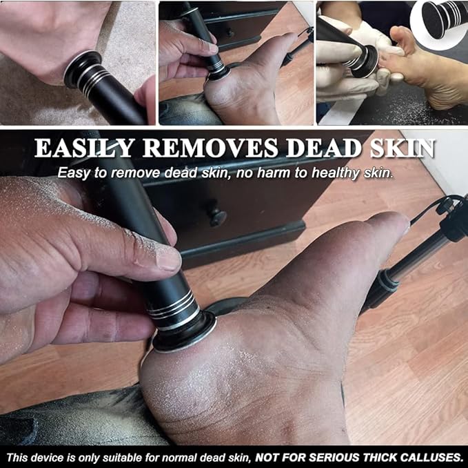 Upgraded electric callus remover for