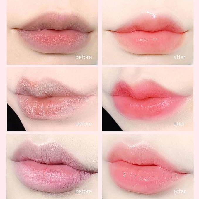 Honey Pot Lip Balm, 4Pcs Honey Hydrating