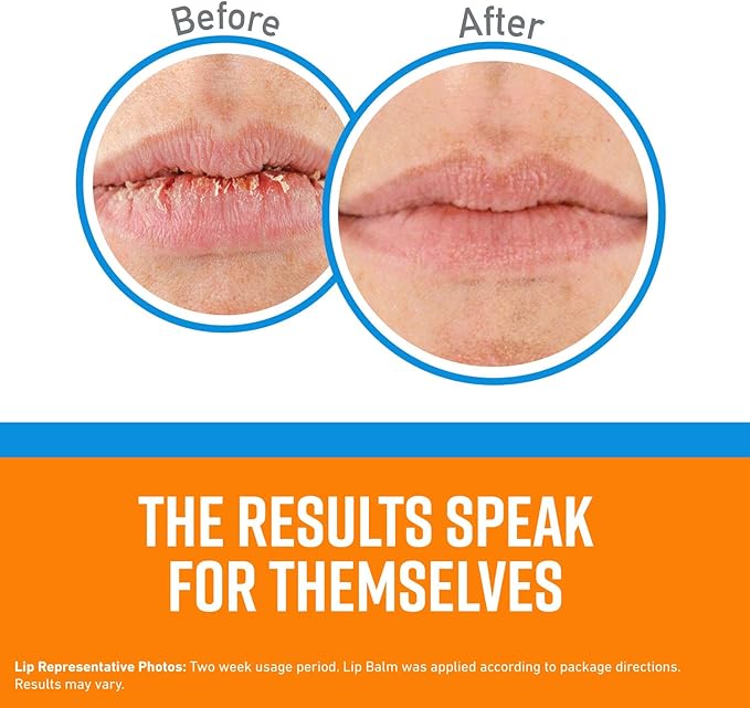 O'Keeffe's Cooling Relief Lip Repair Lip