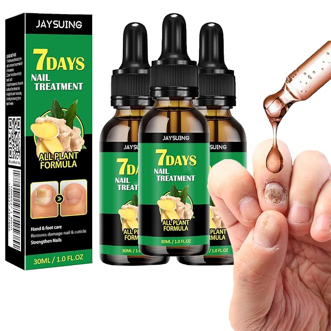 Ginger Nail Treatment Nail Support