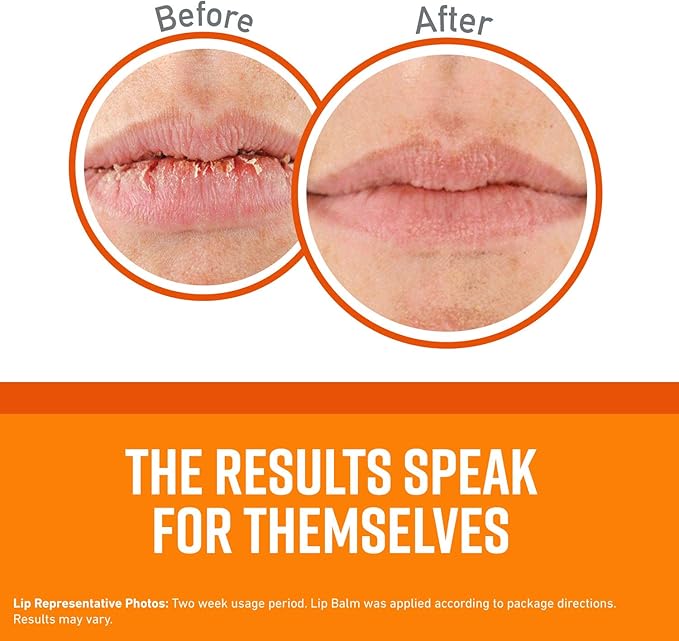 O'Keeffe's Unscented Lip Repair Lip Balm