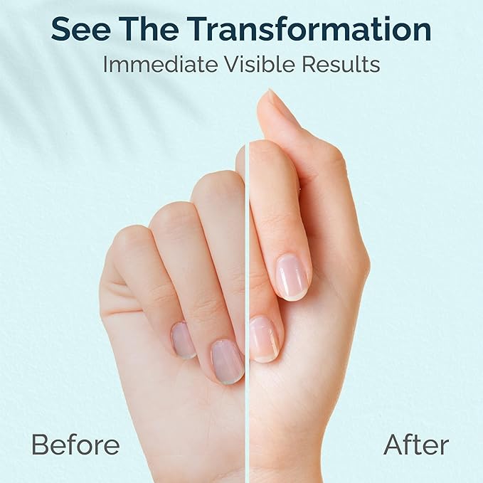 Cuticle & Nail Cream Shea