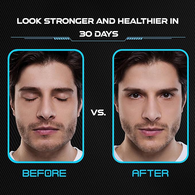 Upgraded Jaw Exerciser for Men & Women - 3 Levels (3 Levels