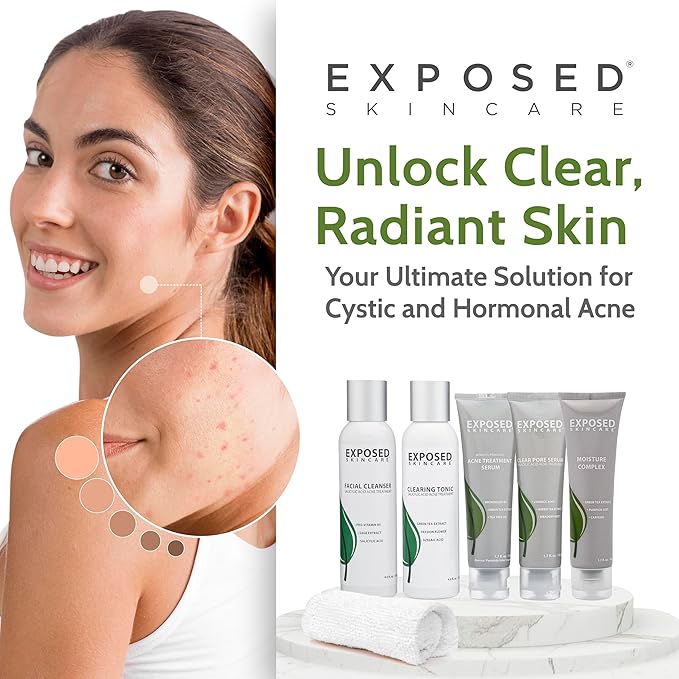 Exposed Skin Care Expanded Acne Treatment Clearing