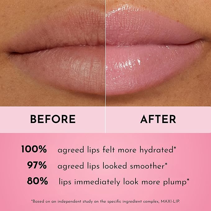 Lawless Forget the Filler Lip Plumping