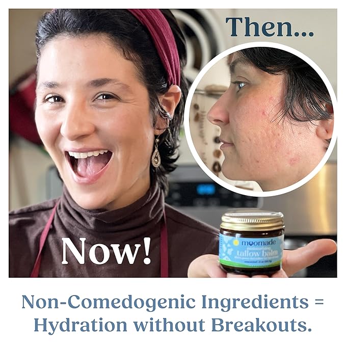 Organic Beef Tallow Balm with Rosehip Oil | Unscented 2 oz – Hand Made in USA 100% Grass-Fed Beef Tallow Moisturizer for Face & Body, Baby, Eczema, Acne-Prone & Sensitive Skin