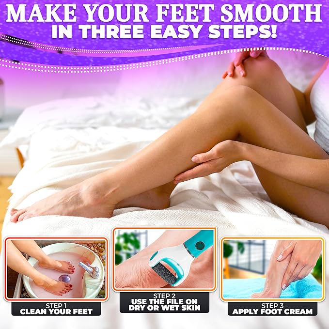 Electric foot callus remover -