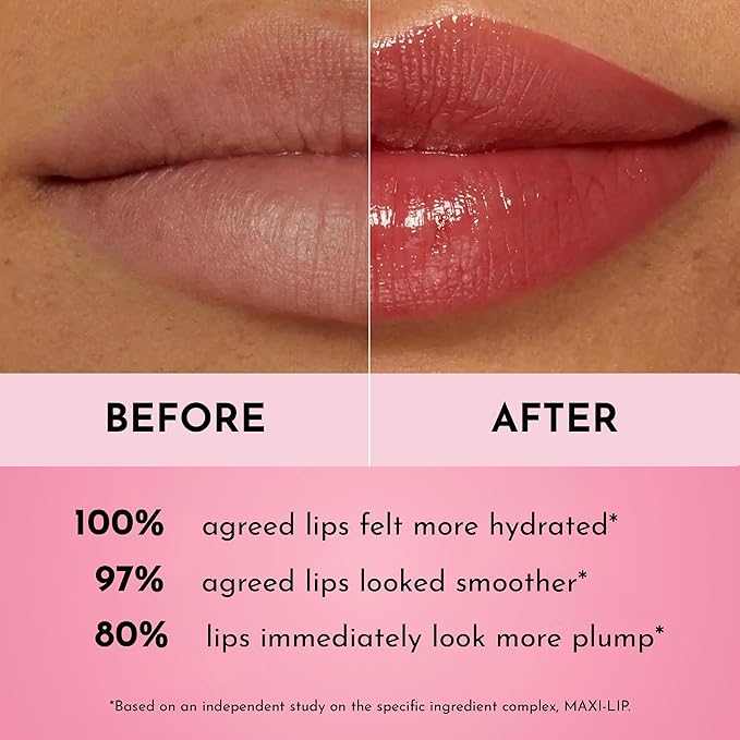 Lawless Forget the Filler Lip Plumping