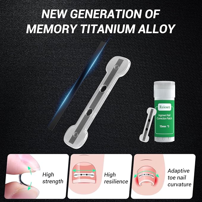 Titanium alloy ingrown toenail treatment-