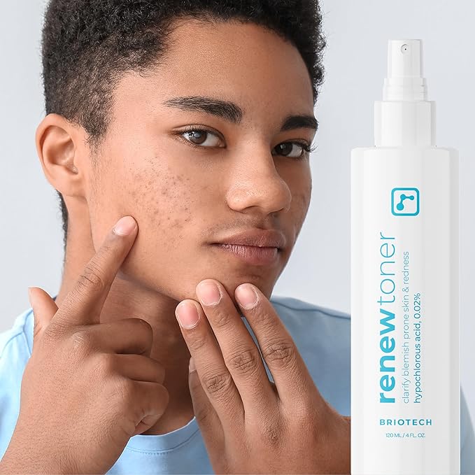 BRIOTECH Skin Renew Toner, Hypochlorous Acid Spray Topical Skin Spray for Face and Skin, Minimize Appearance of Blemishes, Soothing Mist for Redness & Bumps, 4 fl oz ea, 4 ct