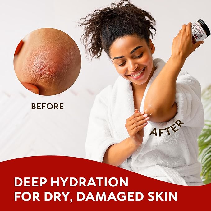 Beef Tallow for Skin - Whipped Grass-Fed Moisturizer with Wild Honey & Beeswax, Natural Face & Body Care, Deep Hydration, Anti-Aging, Sensitive Skin Safe, 100% Organic Balm