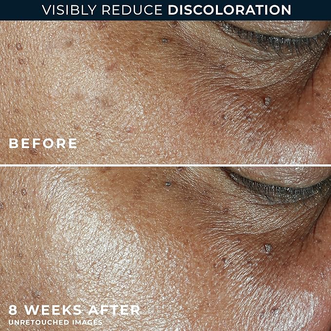 RoC Multi Correxion 5 in 1 Anti-Aging Daily Face Moisturizer with Broad Spectrum SPF 30 & Shea Butter, Skin Care Routine, (1.7 oz) with Night Cream Packette (Packaging May Vary)