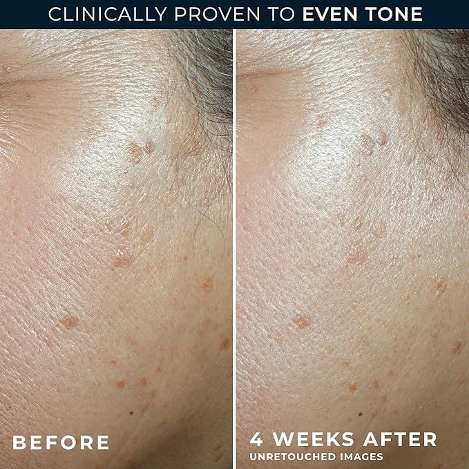 RoC Multi Correxion 5 in 1 Anti-Aging Daily Face Moisturizer with Broad Spectrum SPF 30 & Shea Butter, Skin Care Routine, (1.7 oz) with Night Cream Packette (Packaging May Vary)