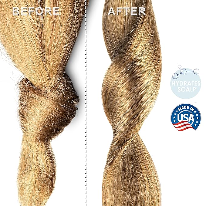 Soapeauty MEADOWFOAM SEED OIL Cold Pressed Unrefined | 100% Pure Natural Meadowfoam Seed Oil for Face & Hair | Moisturizer for Skin, Promotes Hair Growth, Balms | 16 fl oz